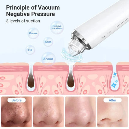 Electric Blackhead Remover Vacuum Acne Cleaner Black Spots Removal